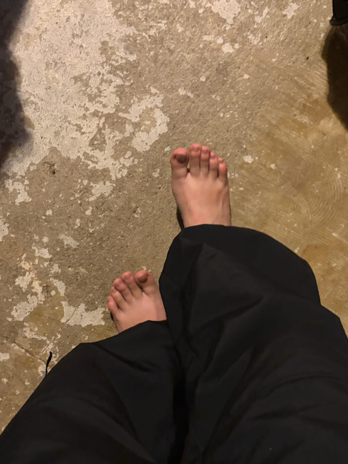 サーキットの次の日なだけあって、すっごい足がむくんでる、